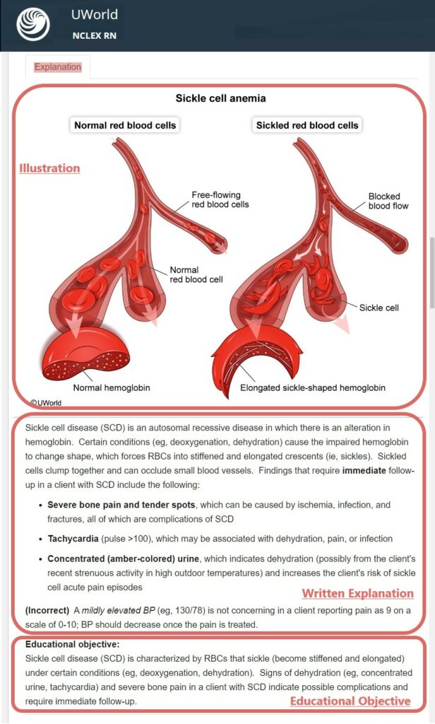 UWorld NCLEX Answer Explanations