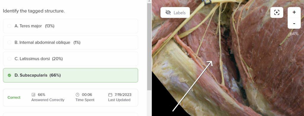 Anatomy Bootcamp Cadaveric Images