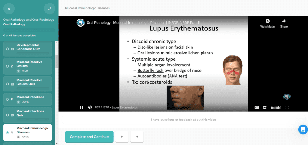 INBDE Bootcamp Mental Dental Video Lessons