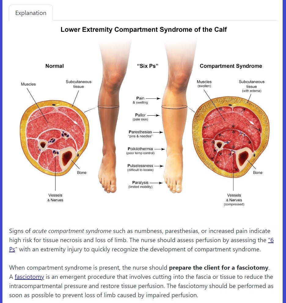 NCLEX Bootcamp Answer Exaplanations